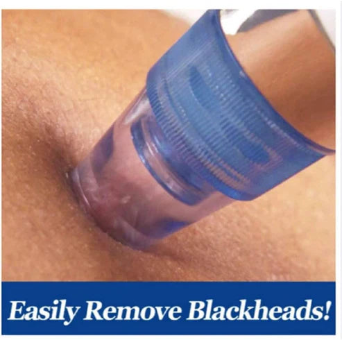 Buy Online Pore Cleaning Device UAE
